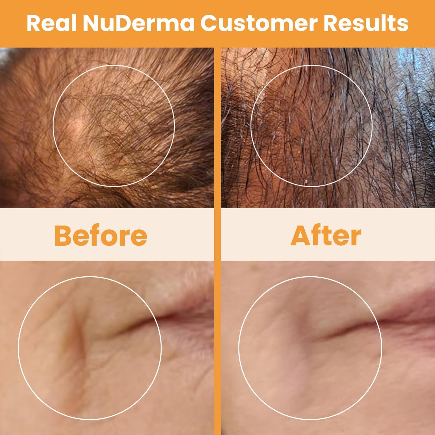 NuDerma Skin Therapy Wand™